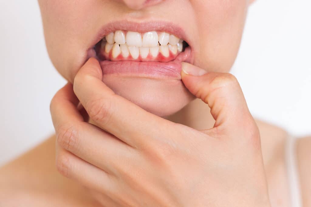 Can Gum Disease Be Reversed? Early Signs and What to Do