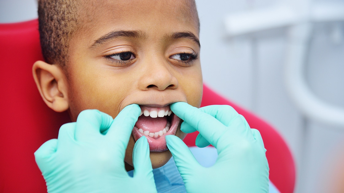 Small child receiving dental cleaning