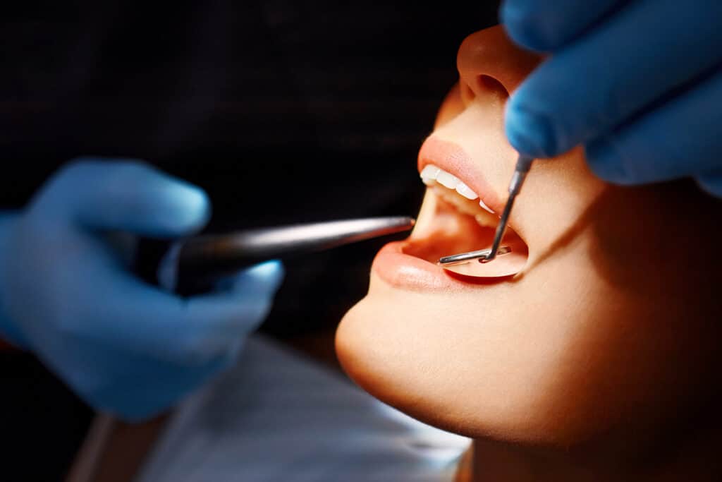 Dental Cleaning vs. Deep Cleaning: What's the Difference?