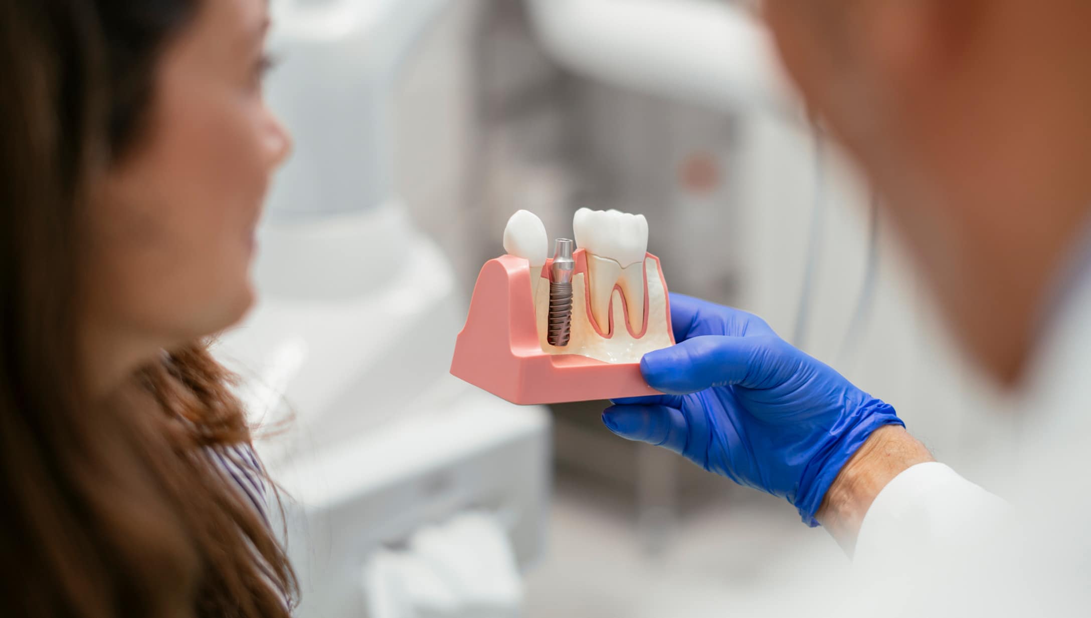 Dental Implant Model