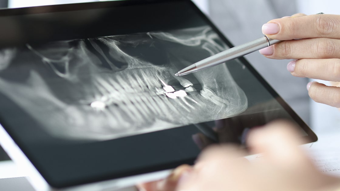 Digital X-ray Image on Tablet