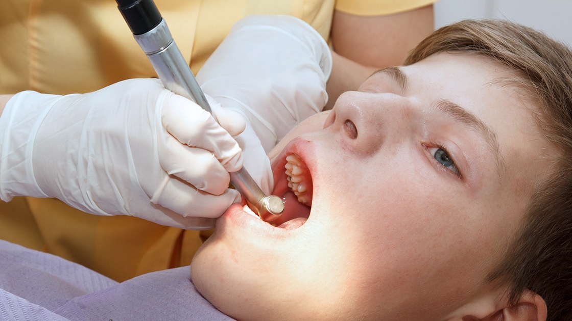 Woman in dental chair with tooth shade guide